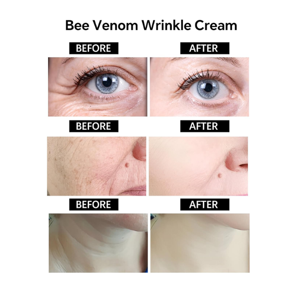 Botox Bee Venom Wrinkle Removal Cream & Recovery for All Skin Type